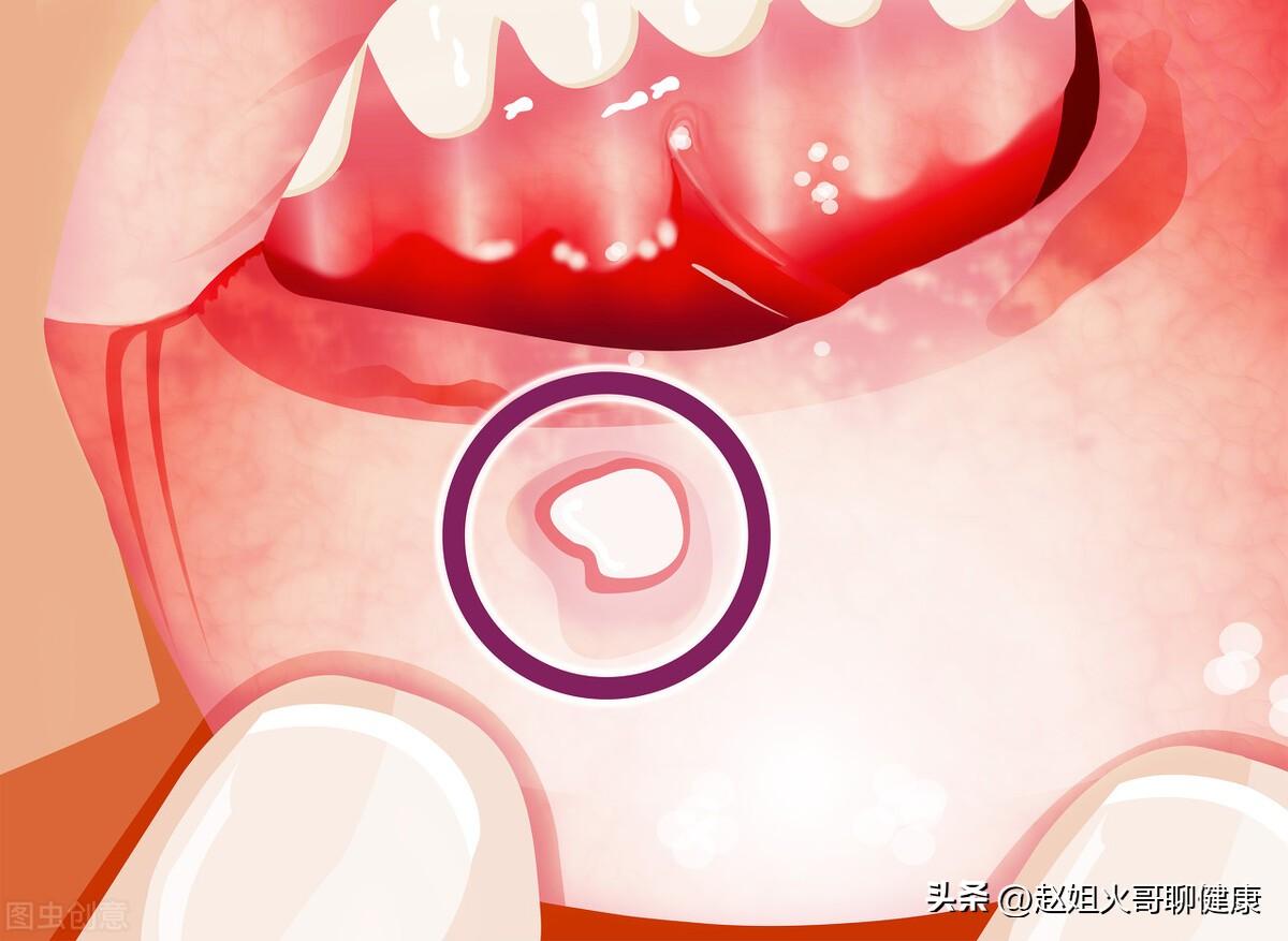 口腔溃疡要多吃的十种水果2026年本年度热度口碑双榜对比